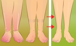 Rétention d’eau : 5 gestes simples qui peuvent aider à réduire les gonflements