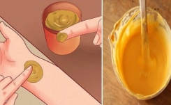 🌿 Le curcuma : un trésor naturel pour apaiser les douleurs et prendre soin de soi