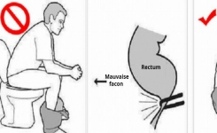 Vous faites caca de la mauvaise manière : Accroupissez-vous pour mieux évacuer