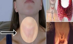 Remède Naturel pour Équilibrer Votre Thyroïde : Recette et Mode d'Emploi