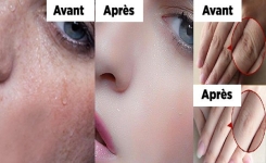 Masque maison au citron, miel et yaourt pour atténuer les taches brunes