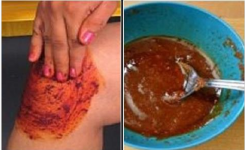  Recette naturelle pour apaiser les douleurs articulaires du genou