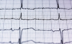 8 signaux corporels qui peuvent indiquer un trouble cardiovasculaire