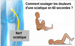Comment soulager les douleurs d'une sciatique rapidement ?